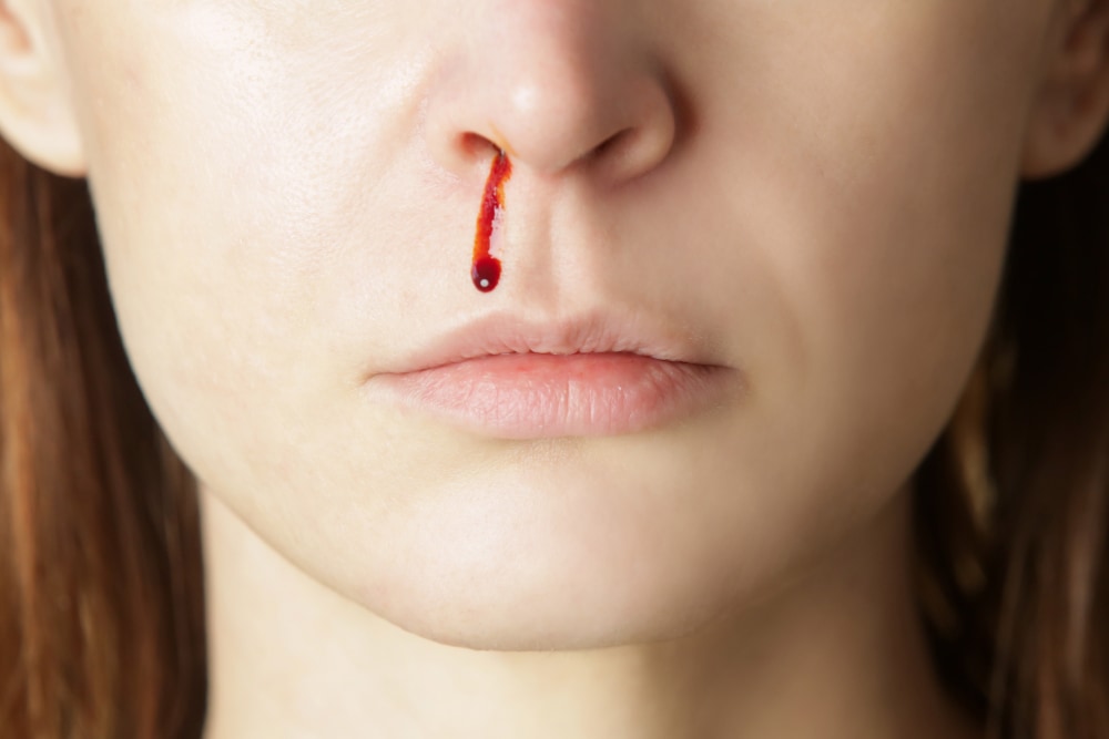 does stress cause nose bleeding